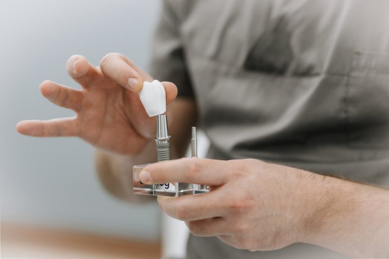 Hand mit Implantat-Modell bei der präzisen Arbeit